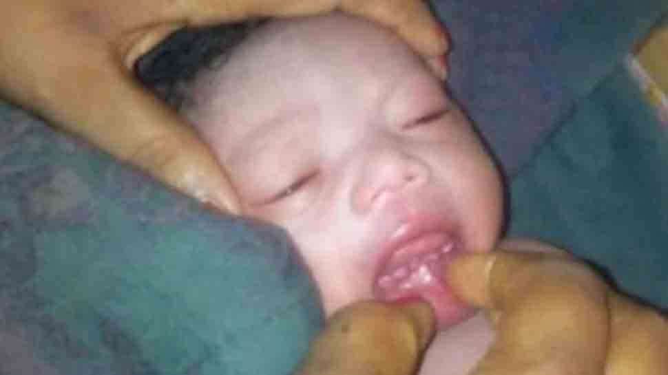 છત્તીસગઢમાં પાંચ દાત સાથે બાળકનો જન્મ: પુજા કરવા માટે લોકોનાં ટોળા ઉમટ્યાં