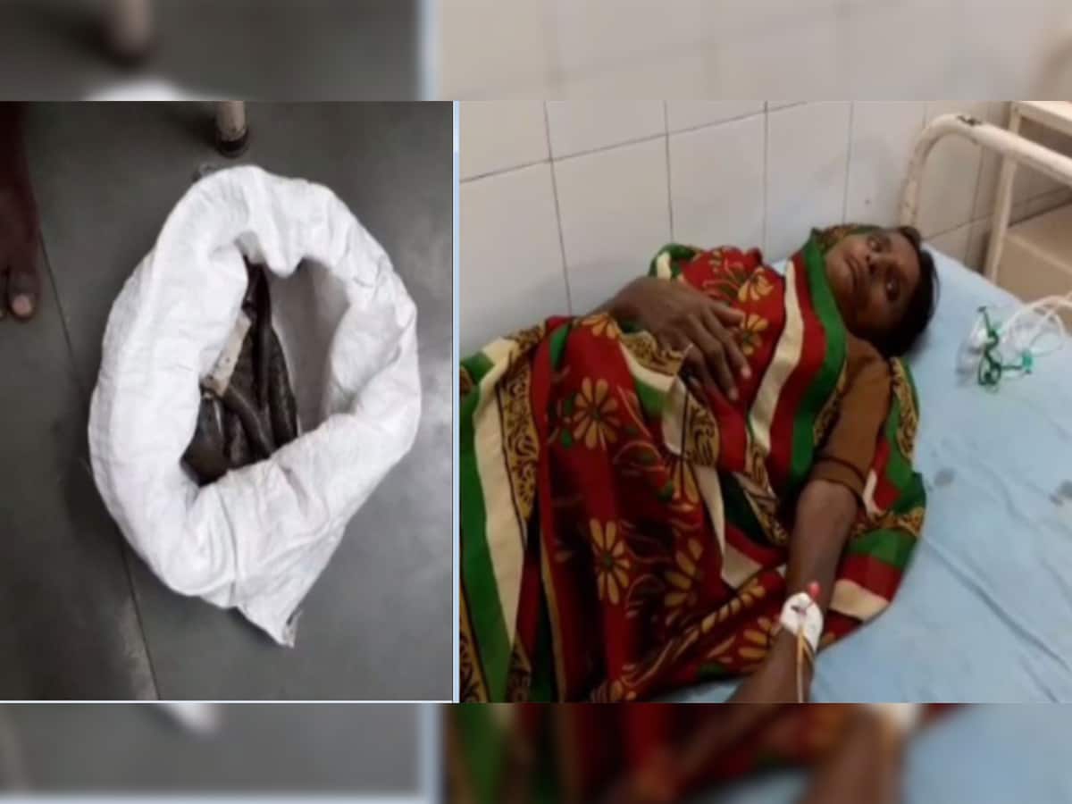મહિલાની સારવાર માટે કોથળામાં લાવેલી વસ્તુ જોઈને ચોંકી ગયા ડોક્ટર્સ, પાલનપુરની ઘટના 