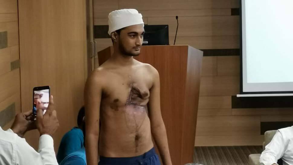 વિચિત્ર કિસ્સો : હાઈટેન્શન વાયરના કરંટથી કિશોરનું હૃદય પણ દાઝ્યું, જટિલ સર્જરી કરીને બચાવી લેવાયો જીવ વિચિત્ર કિસ્સો : હાઈટેન્શન વાયરના કરંટથી કિશોરનું હૃદય પણ દાઝ્યું, જટિલ સર્જરી કરીને બચાવી લેવાયો જીવ