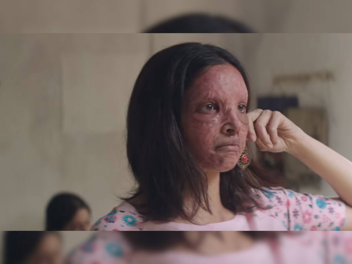 Chhapaak trailer Out: દીપિકા પાદુકોણની ફિલ્મ છપાકનું ટ્રેલર રિલીઝ, જોઈને રૂંવાડા થશે ઉભા 