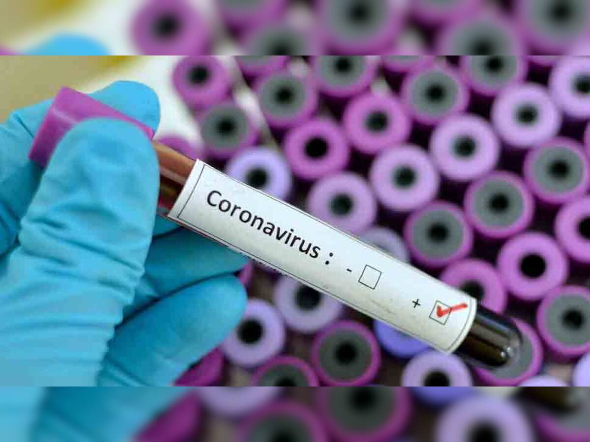 કોરોનાની રસીનું પહેલીવાર થયું પરીક્ષણ, પરિણામ આવતા લાગશે આટલો સમય 
