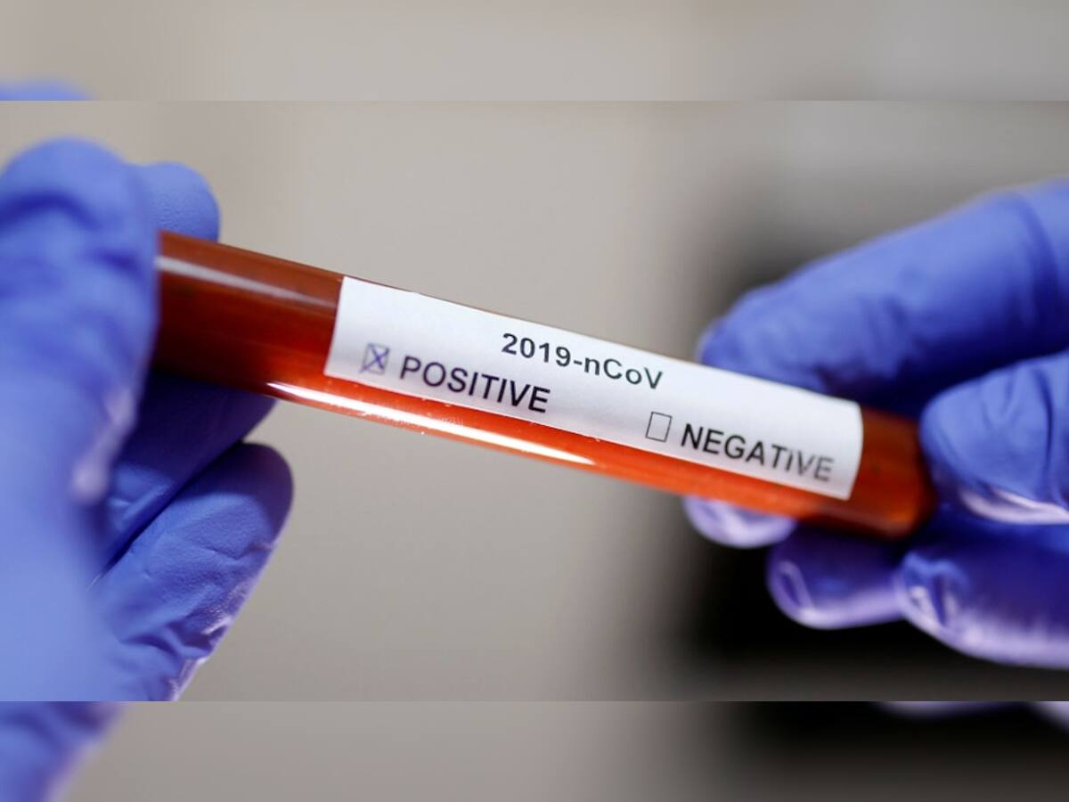 Coronavirus UPDATES: મુંબઇમાં કોરોના સંક્રમણથી વધુ એક મોત, ભારતમાં અત્યાર સુધી 8 લોકોના મોત