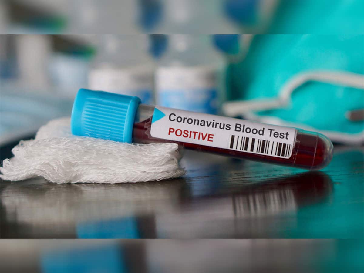 કોરોનાની રસી વિકસાવવા માટે આ ભારતીય કંપની લેશે ઓસ્ટ્રેલિયન યુનિવર્સિટીની મદદ