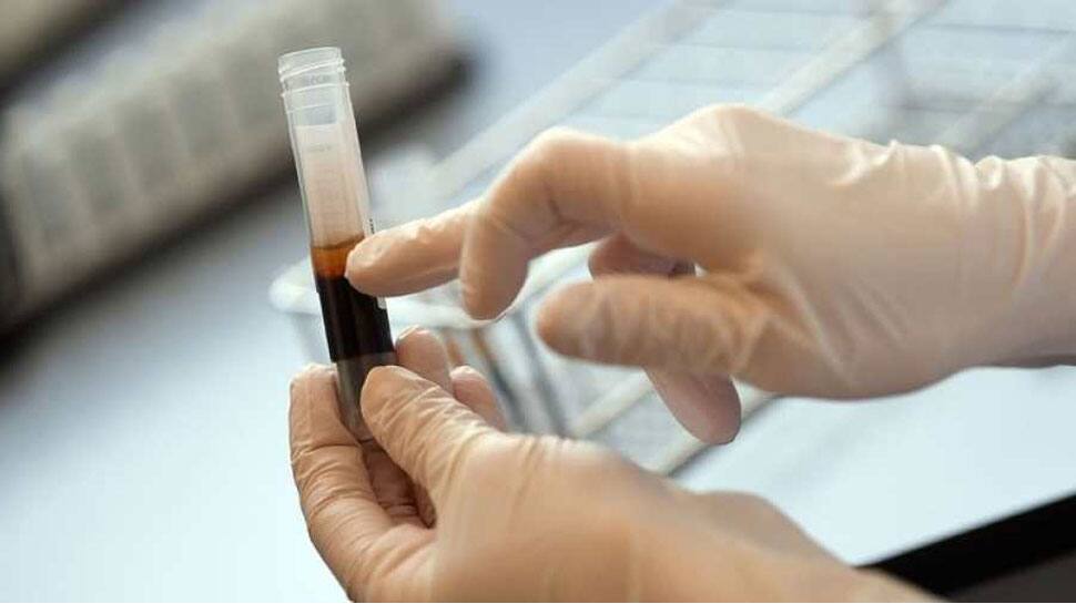 દેશમાં પ્રથમ વખત Plasma Therapyથી કોરોના દર્દીની સારવાર, જાણો કેટલી અસરકારક છે આ થેરાપી દેશમાં પ્રથમ વખત Plasma Therapyથી કોરોના દર્દીની સારવાર, જાણો કેટલી અસરકારક છે આ થેરાપી