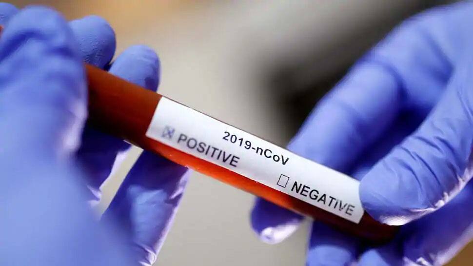 Coronavirus: વડોદરા, સુરત અને કચ્છ સહિત આ શહેરોમાં આવ્યા પોઝિટિવ કેસ Coronavirus: વડોદરા, સુરત અને કચ્છ સહિત આ શહેરોમાં આવ્યા પોઝિટિવ કેસ