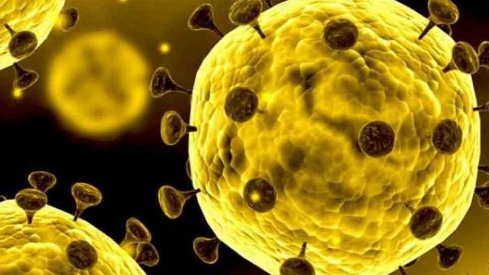 જો તમારું ઘર ‘આવું’ હોય તો તમે Corona virus થી સુરક્ષિત નથી જો તમારું ઘર ‘આવું’ હોય તો તમે Corona virus થી સુરક્ષિત નથી