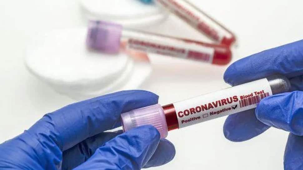 Coronaupdate: છેલ્લા 24 કલાકમાં 540 કેસ, 340 દર્દી ડિસ્ચાર્જ; મૃત્યુઆંત 1600ને પાર Coronaupdate: છેલ્લા 24 કલાકમાં 540 કેસ, 340 દર્દી ડિસ્ચાર્જ; મૃત્યુઆંત 1600ને પાર