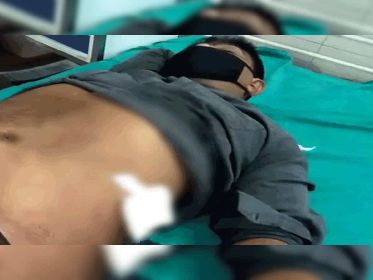 વડોદરા: મેમણ કોલોનીમાં લોનની ઉઘરાણીએ ગયેલા 2 પર છરીથી હુમલો, એક ગંભીર