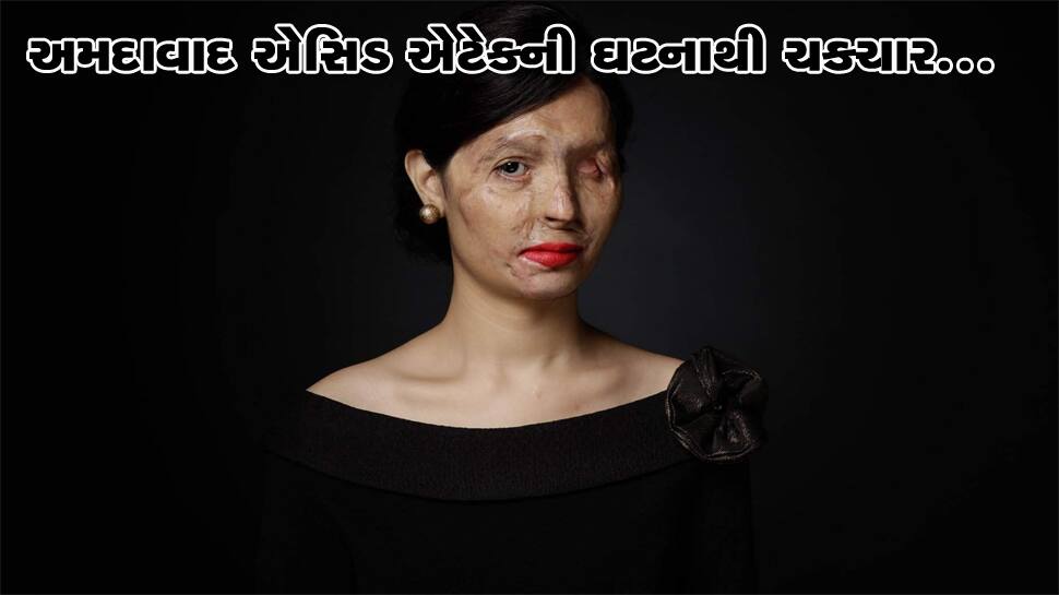 ગુજરાતમાં એસિડ એટેક ! નિંદ્રાધીન મહિલા પર એસિડ એટેક થતા સમગ્ર વિસ્તારમાં ચકચાર મચી ગુજરાતમાં એસિડ એટેક ! નિંદ્રાધીન મહિલા પર એસિડ એટેક થતા સમગ્ર વિસ્તારમાં ચકચાર મચી