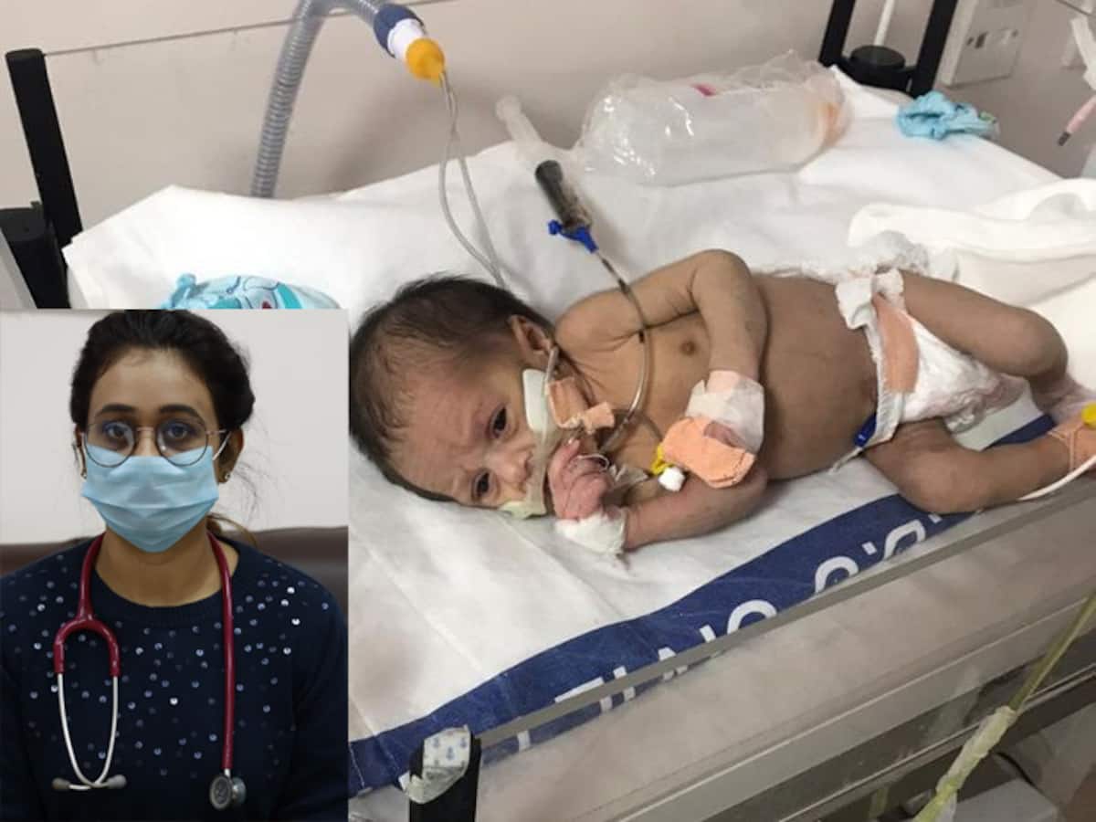 રાજકોટ: અધુરા મહિને જન્મેલા બાળકને Corona  આવ્યો, ડોક્ટર્સ યમરાજ સામે માંડ્યો મોરચો અને પછી