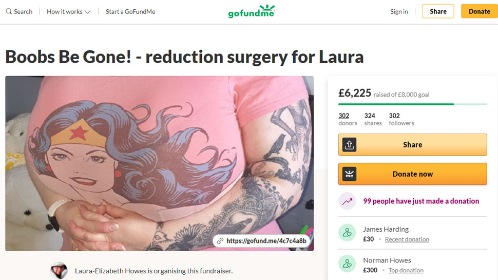 British Women with heavy breasts raising funds online for breast