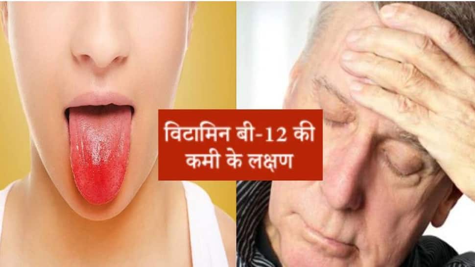 શરીરમાં આવા બદલાવ દેખાય તો થઈ જજો સાવધાન! B 12ની કમીથી થાય છે આ ગંભીર બીમારીઓ શરીરમાં આવા બદલાવ દેખાય તો થઈ જજો સાવધાન! B 12ની કમીથી થાય છે આ ગંભીર બીમારીઓ
