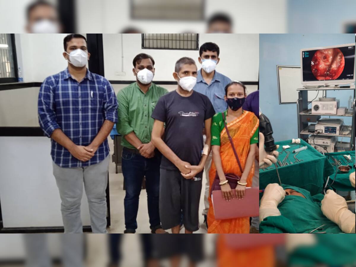 Mucormycosis ના દર્દીની સભાન અવસ્થામાં લગભગ સાડા ત્રણ કલાક કરી સર્જરી 