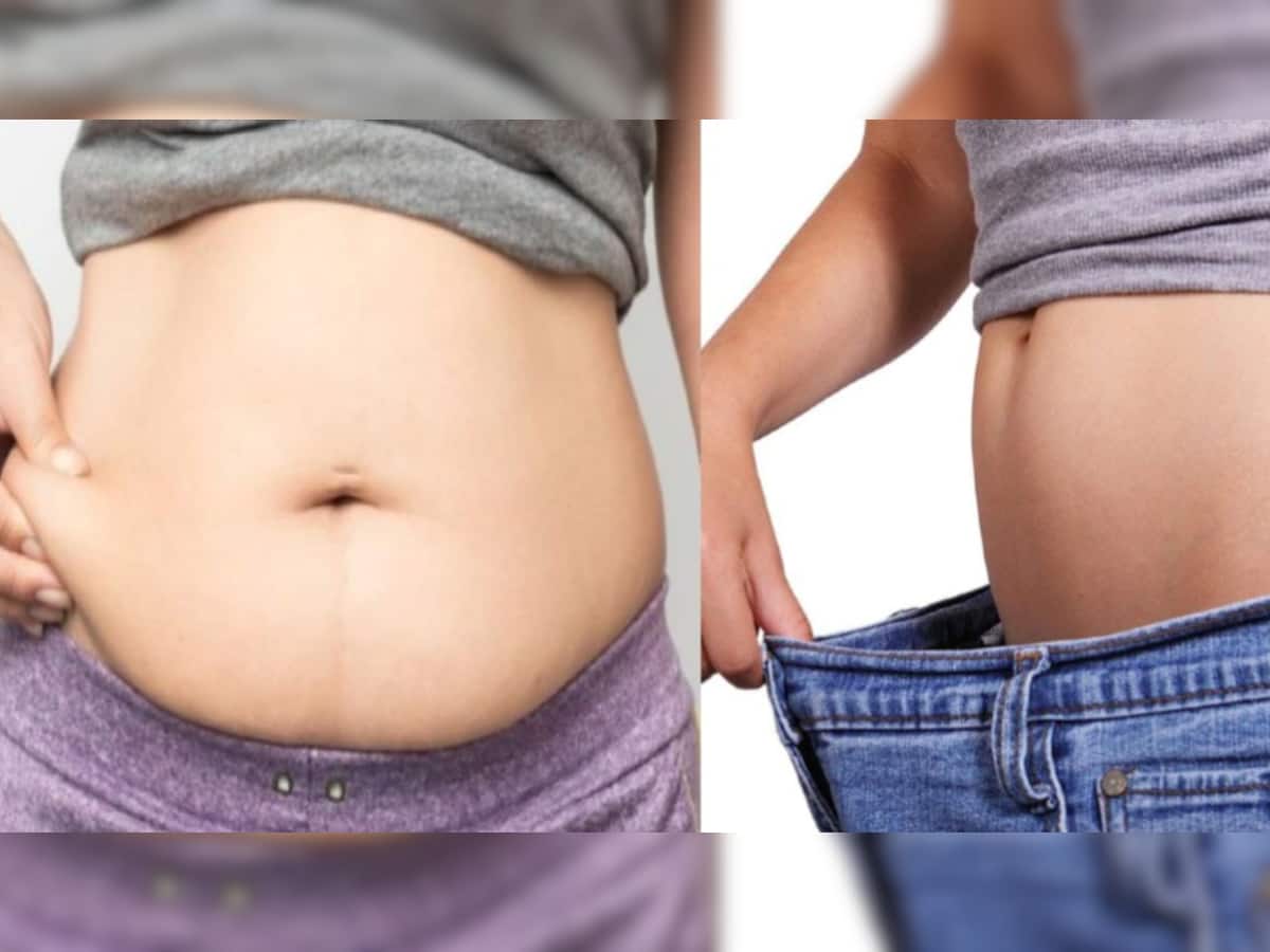 Belly Fat: જાણો પેટની ચરબીના હોય છે કેટલાં પ્રકાર, આ રીતે ફટાફટ ઘટાડો પેટની ચરબી