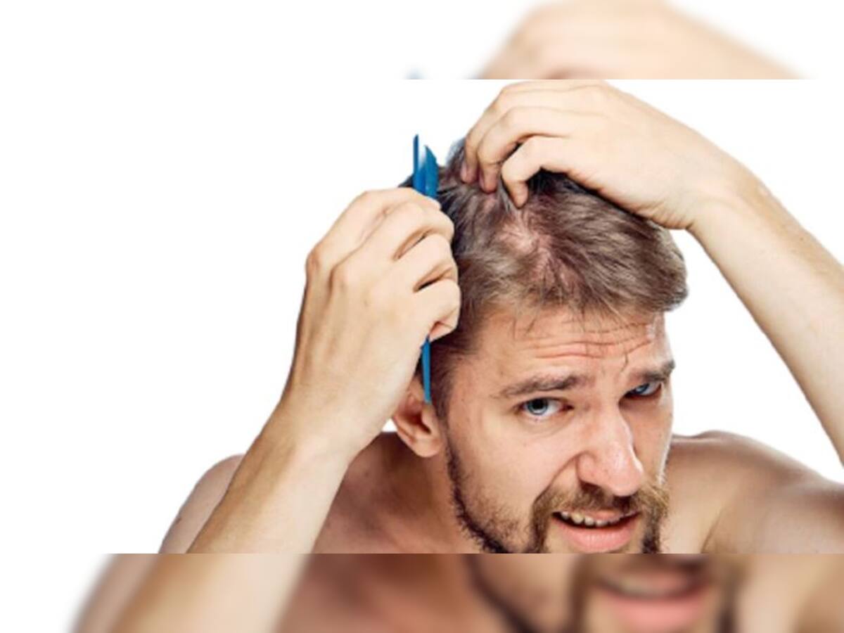 Tips for Hair Care: માથામાં જૂ પડી ગઈ છે? તો ફીકર નોટ, બસ આ ઉપાય કરો જૂ થઈ જશે છુમંતર