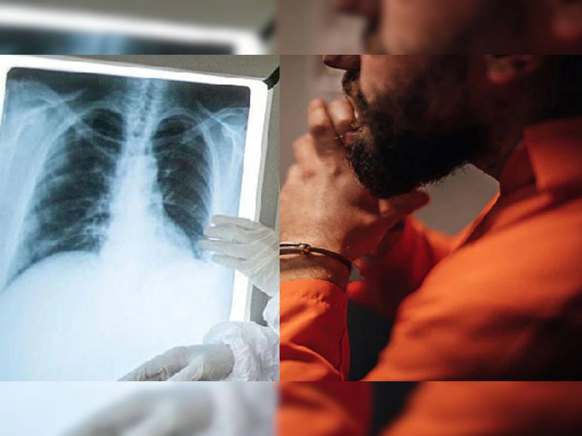 કેદીનો X-ray જોઇ ડોક્ટરના ઉડી ગયા હોશ, પેટમાં સંતાડ્યો હતો મોબાઇલ