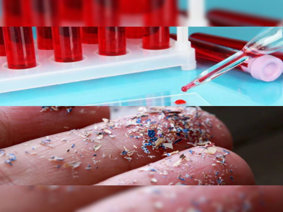 Microplastics found in human blood: પહેલીવાર મનુષ્યના લોહીમાંથી મળી આ વસ્તુ, આ ડરામણી ચીજથી વૈજ્ઞાનિકોના હોશ ઉડ્યા