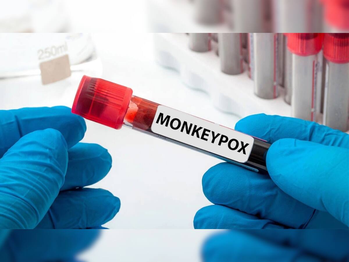 Monkeypox Cases In India: મંકીપોક્સનો બીજો કેસ સામે આવતા કેન્દ્ર એલર્ટ, એરપોર્ટ અને પોર્ટ પર સ્ક્રીનિંગના આપ્યા નિર્દેશ