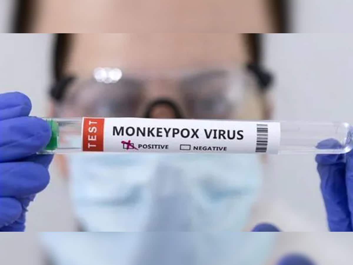 Monkeypox Case: ભારતના આ રાજ્યમાં મંકીપોક્સનો પહેલો કેસ આવ્યો સામે, જોઈ ડોક્ટરના ઉડ્યા હોશ