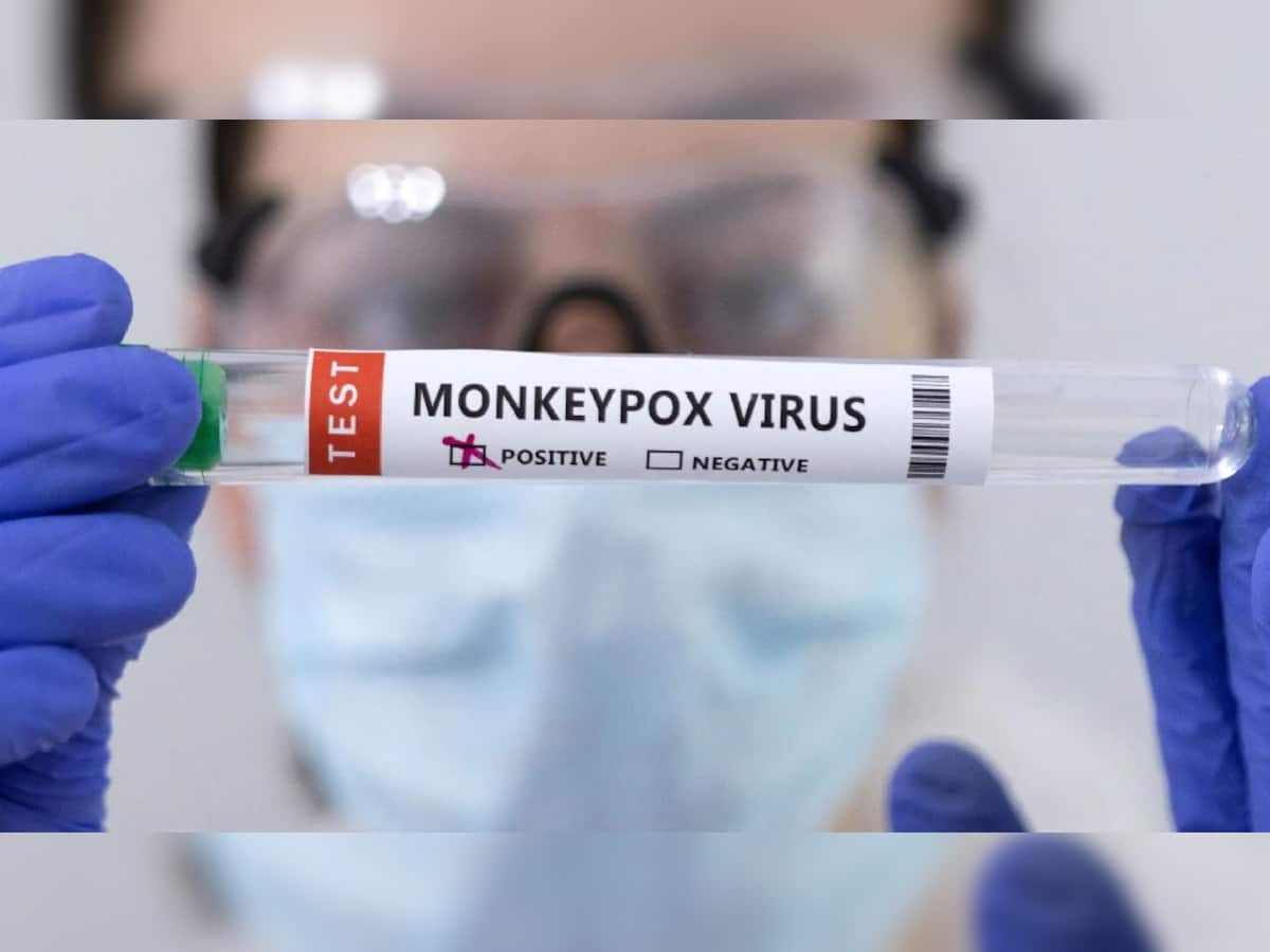 Monkeypox Case in Delhi: શું હવે મંકીપોક્સ બનશે ખતરો? દિલ્હીમાં વધુ એક સંક્રમિત, દેશમાં કુલ 8 કેસ