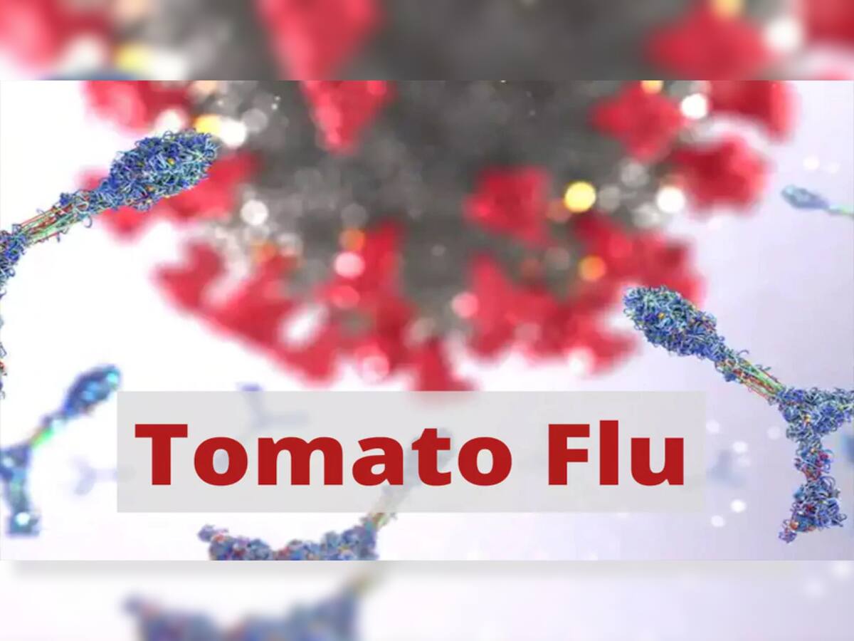 Tomato Flu: તમારા બાળકોનું રાખો ખાસ ધ્યાન, કોરોના બાદ આ વાયરસ માત્ર બાળકોને બનાવી રહ્યો છે શિકાર