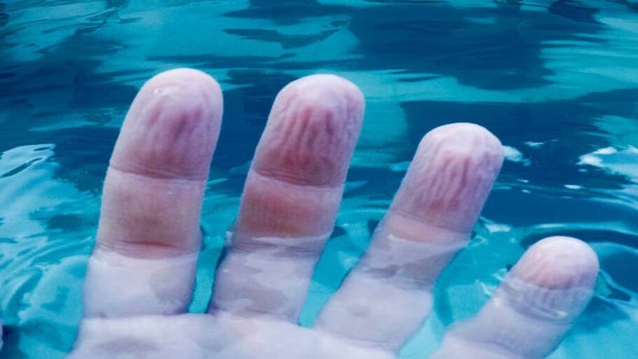 knowledge news fact check reason for skin wrinkles easily in water