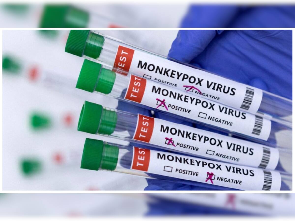 Monkeypox Symptoms: રિસર્ચમાં મંકીપોક્સના નવા લક્ષણો સામે આવ્યા, તમારા માટે જાણવા ખુબ જરૂરી 