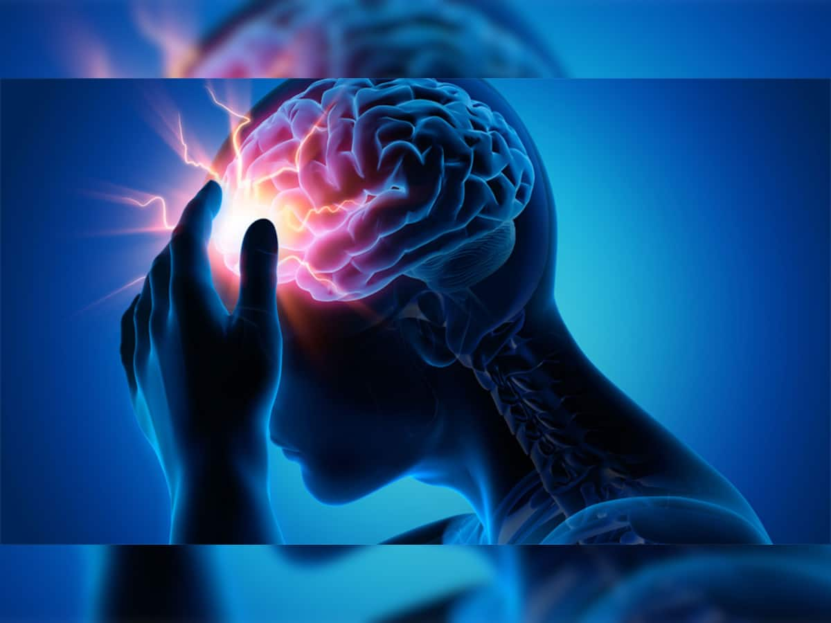 World Stroke Day: કોવિડ બાદ સ્ટ્રોક બિમારીમાં થયો વધારો, જેનેરિક દવાઓથી ઘટ્યું આર્થિક ભારણ