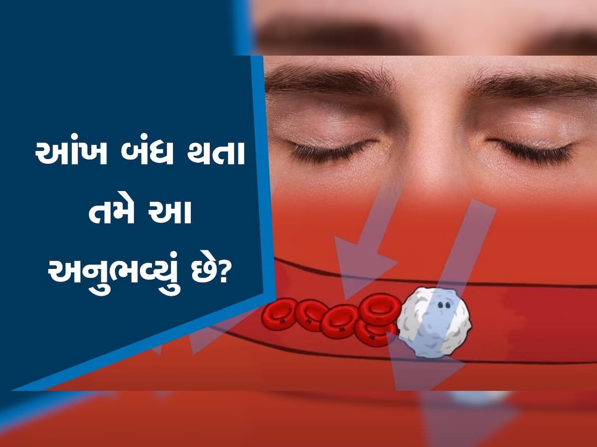 MUSCAE OF EYE: ઘણી વખત આંખોની સામે નાચવા લાગે છે અજીબ કીડાઓ, જાણો એની પાછળનું શું છે કારણ