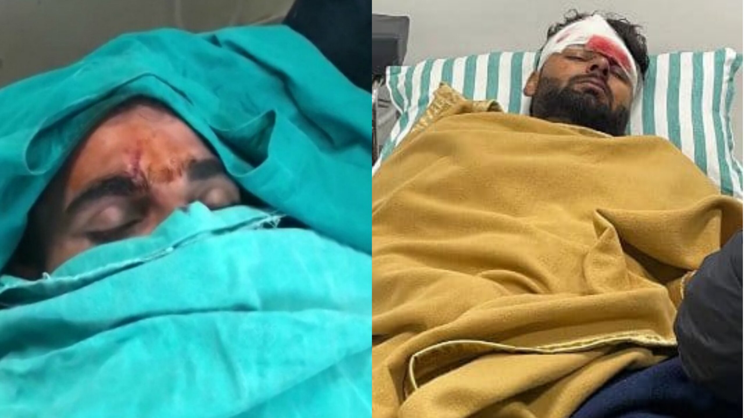ઋષભ પંતની કારનો ગંભીર અકસ્માત