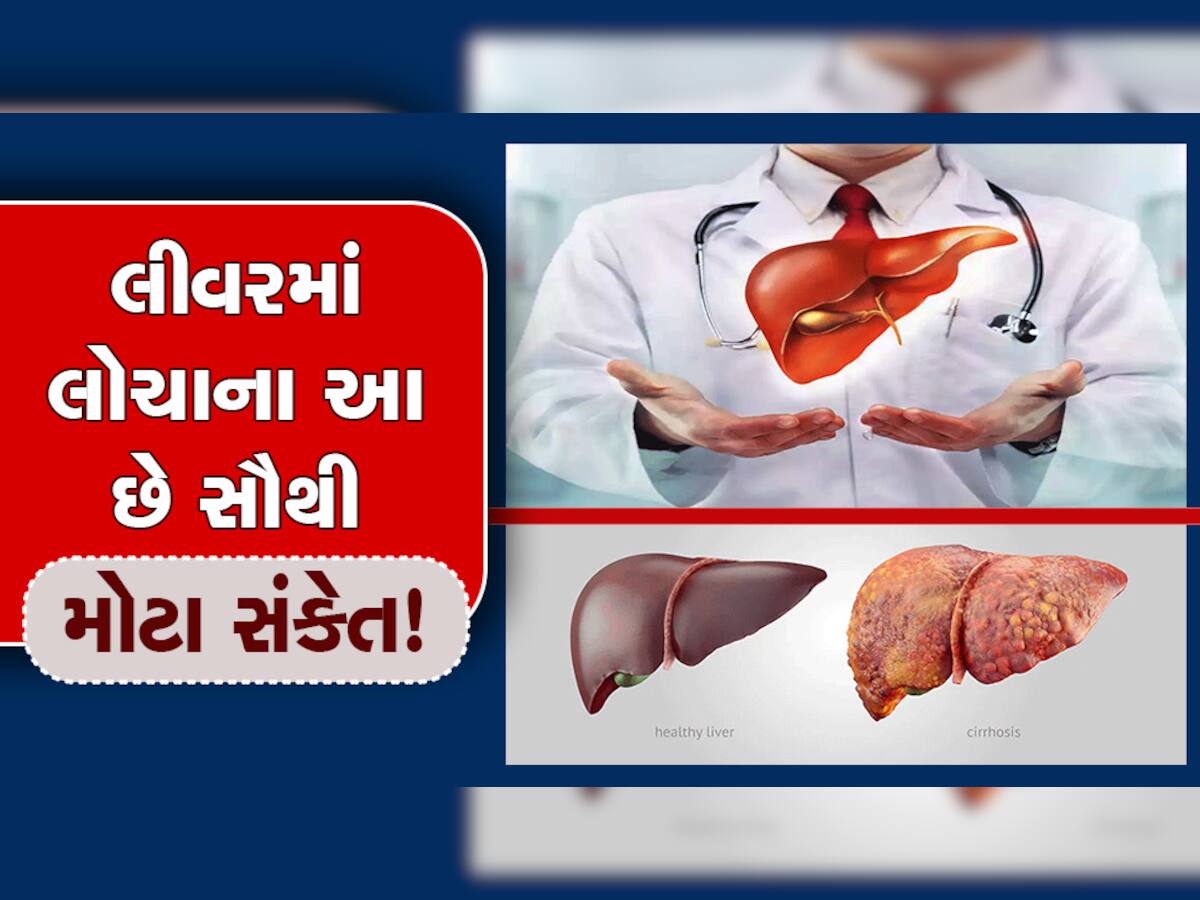 Liver Disease Symptoms: લીવરમાં લોચાના આ છે સૌથી મોટા સંકેત! તમે પણ એકવાર કરી લેજો ચેક