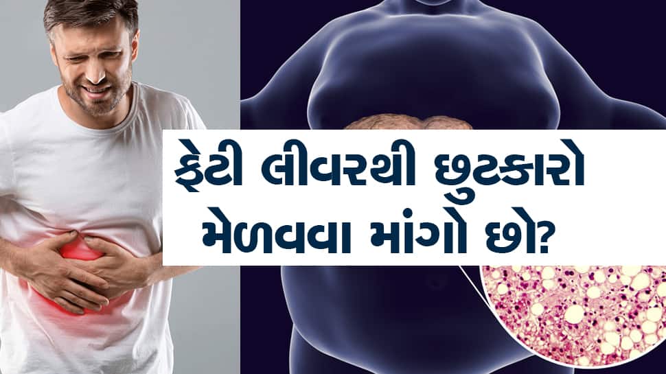 Fatty Liver Diet lifestyle Liver Disease liver detox health care tips