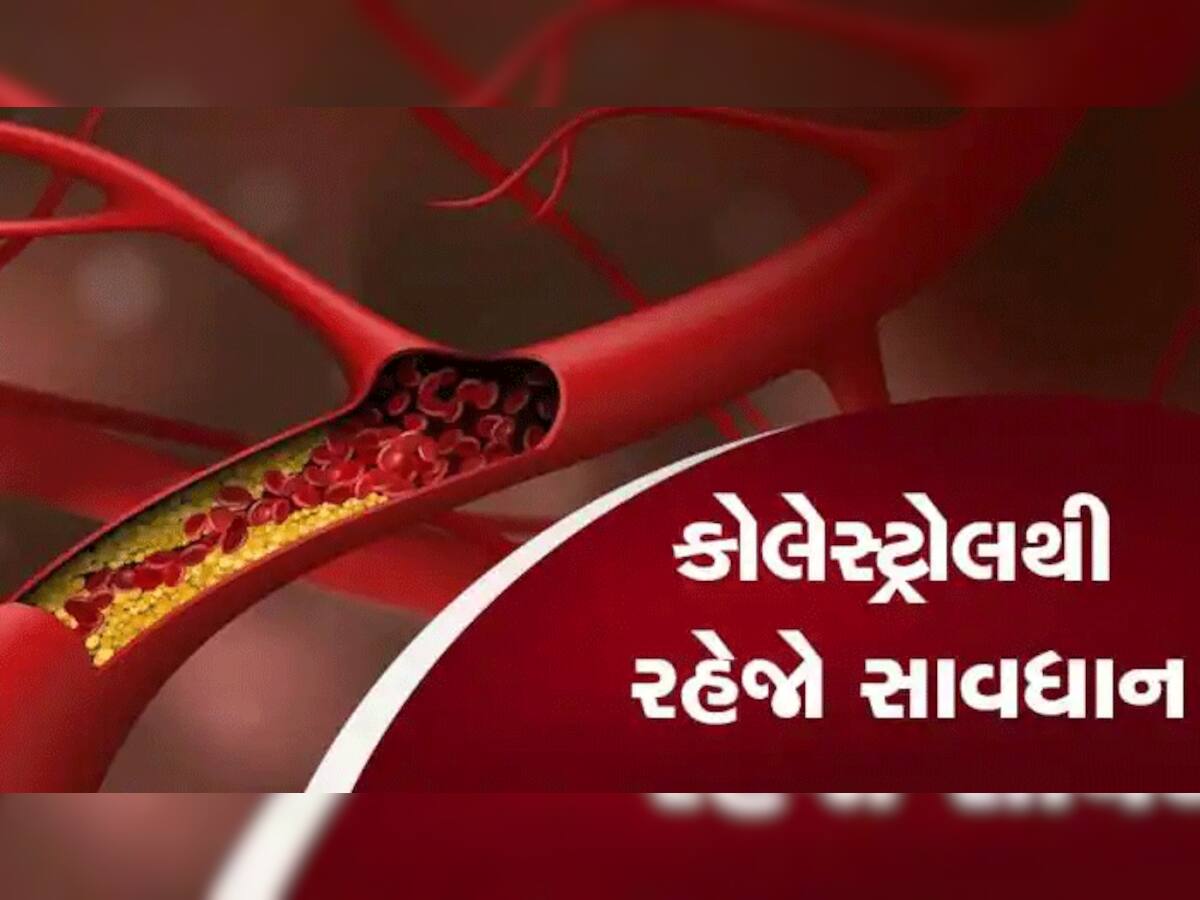 Cholesterol Effects: ઠંડીમાં આ ભૂલોથી વધી જાય છે કૉલેસ્ટ્રોલનું લેવલ, રાખો આ વાતોનું ધ્યાન