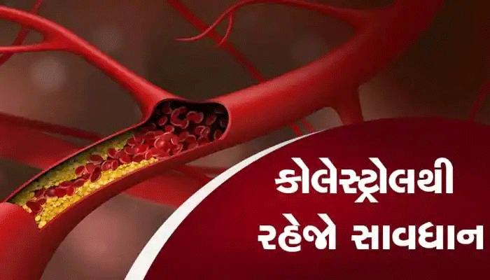 Cholesterol Effects: ઠંડીમાં આ ભૂલોથી વધી જાય છે કૉલેસ્ટ્રોલનું લેવલ, રાખો આ વાતોનું ધ્યાન
