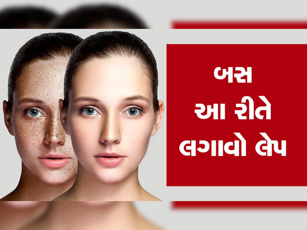 How To Get Spotless Skin: ચહેરા પરના ડાઘ દૂર કરી બનાવી દેશે તમને સુપર મોડલ, બસ આ રીતે લગાવો 