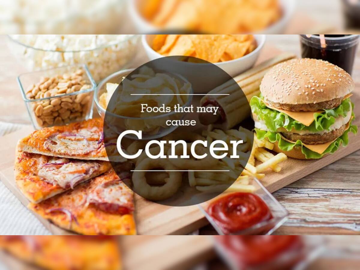 World Cancer Day 2023: એક નહીં 34 પ્રકારના કેન્સરને આમંત્રણ આપે છે આ ફૂડ, તમે તો નથી ખાતા ને