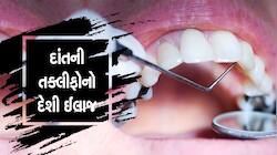 Teeth Cavities: શું તમે પણ દાંતમાં કેવિટી કે સડાથી પરેશાન છો ? આ ઉપાયથી મેળવો છુટકાર