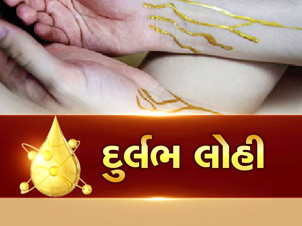 Golden Blood: દુનિયામાં માત્ર 43 લોકોના શરીરમાં છે આ 'ગોલ્ડન બ્લડ', જાણો શું છે આ લોહીની ખાસિયત