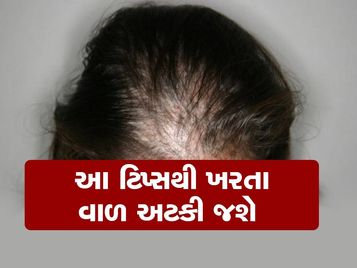 HAIR FALL: માથામાંથી ખરી રહ્યા છે વાળ, ફિકર નોટ!, અપનાવશો આ ટિપ્સ તો નહીં બનો ટાલિયાપણાનો શિકાર 