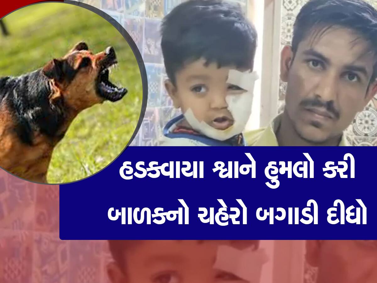 હડકાયા શ્વાનના બચકાથી બાળકનો ચહેરો બગડી ગયો, 84 ટાંકા લઈને તબીબોએ બચાવી લીધો જીવ