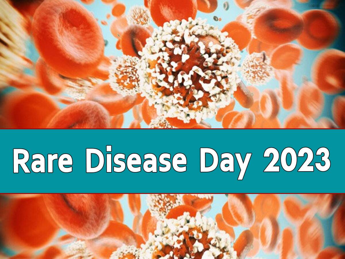 Rare Disease Day 2023: આજે દુર્લભ રોગ દિવસ, જાણો ઉજવવા પાછળનું કારણ અને આ વખતની થીમ