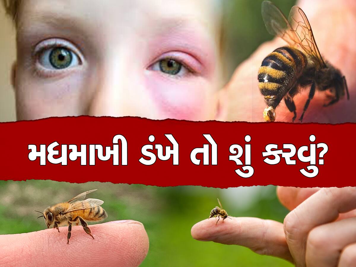 Bee Bites: મધમાખી ડંખ મારે પછી તરત જ કરો આ ઘરગથ્થુ ઉપચાર,  સોજા અને દુખાવામાં મળશે રાહત 