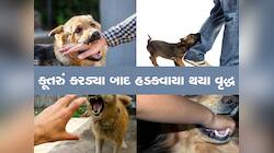 કૂતરું કરડે તો હળવાશમાં ન લેતા, સુરતના વૃદ્ધ પાણી અને લાઈટના પ્રકાશથી ડરવા લાગ્યા