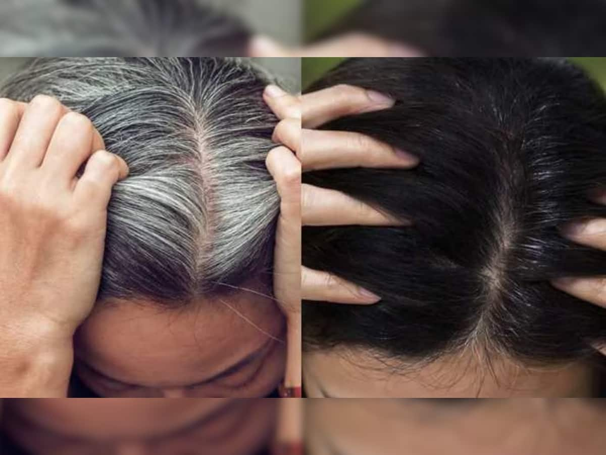 White Hair: લગ્નની ઉંમરમાં સફેદ વાળ આવી ગયા છે? પીવો આ આર્યુવેદિક જ્યૂસ, વાળ થઇ જશે કાળા ભમ્મર