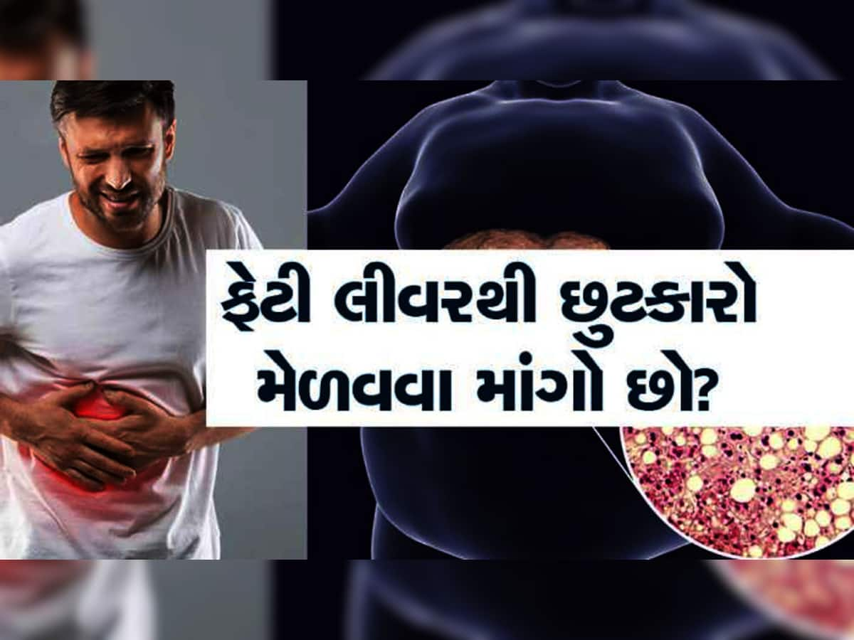 Fatty Liver Diet: લીવરમાં લોચા હોય તો શું ખાવું અને શું ન ખાવું? જાણો કઈ રીતે દૂર થશે લીવરનું દુઃખ