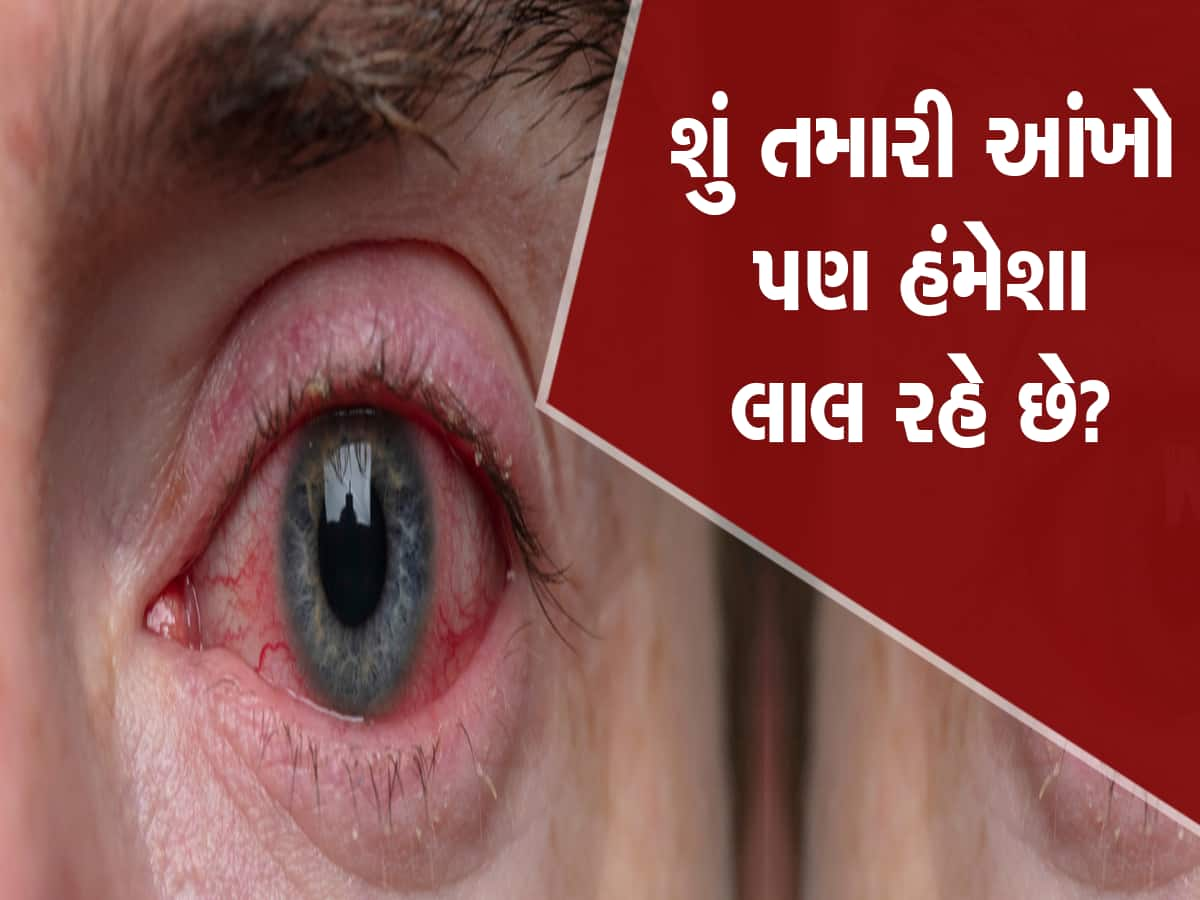 હંમેશા લાલ રહેતી આંખો આ સમસ્યાનો હોઈ શકે છે સંકેત! ઇગ્નોર કરવાની ભૂલ ન કરતા