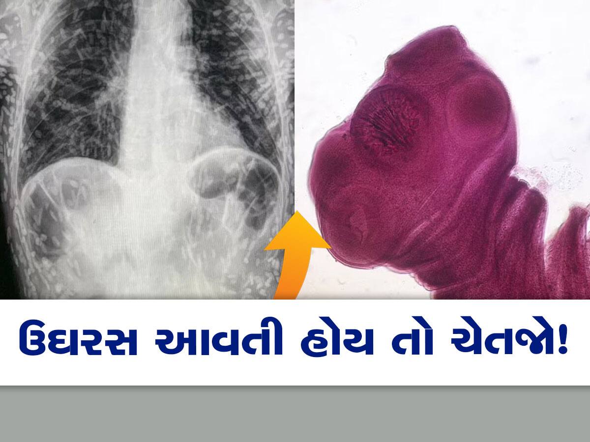 OMG! એક્સરે જોઈને ડોક્ટરોના રૂવાડાં ઉભા થઈ ગયા, એક બે નહીં શરીરમાં હતા ડઝન કીડા 