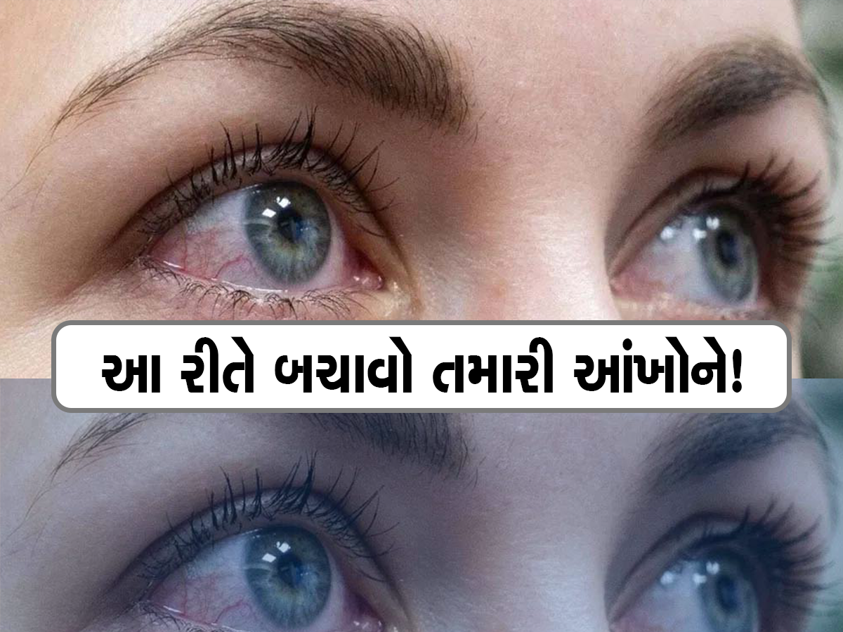 અમદાવાદ સહિત ગુજરાતભરમાં ડ્રાય આંખના દર્દીઓમાં વધારો; જાણો આંખોને શુષ્ક કરી નાખતી આ બિમારી કેટલી છે ગંભીર 