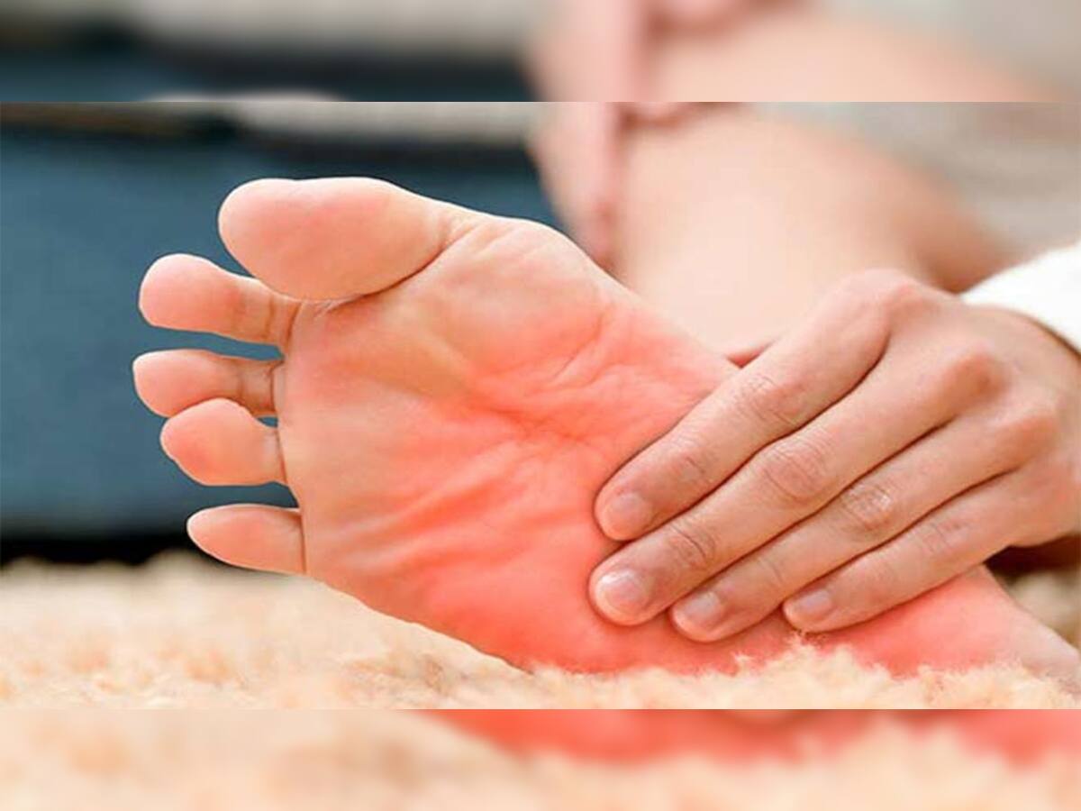 પગના તળીયામાં થતી બળતરાની ન કરવી અવગણના, આ ગંભીર સમસ્યાના કારણે પણ થઈ શકે છે તકલીફ