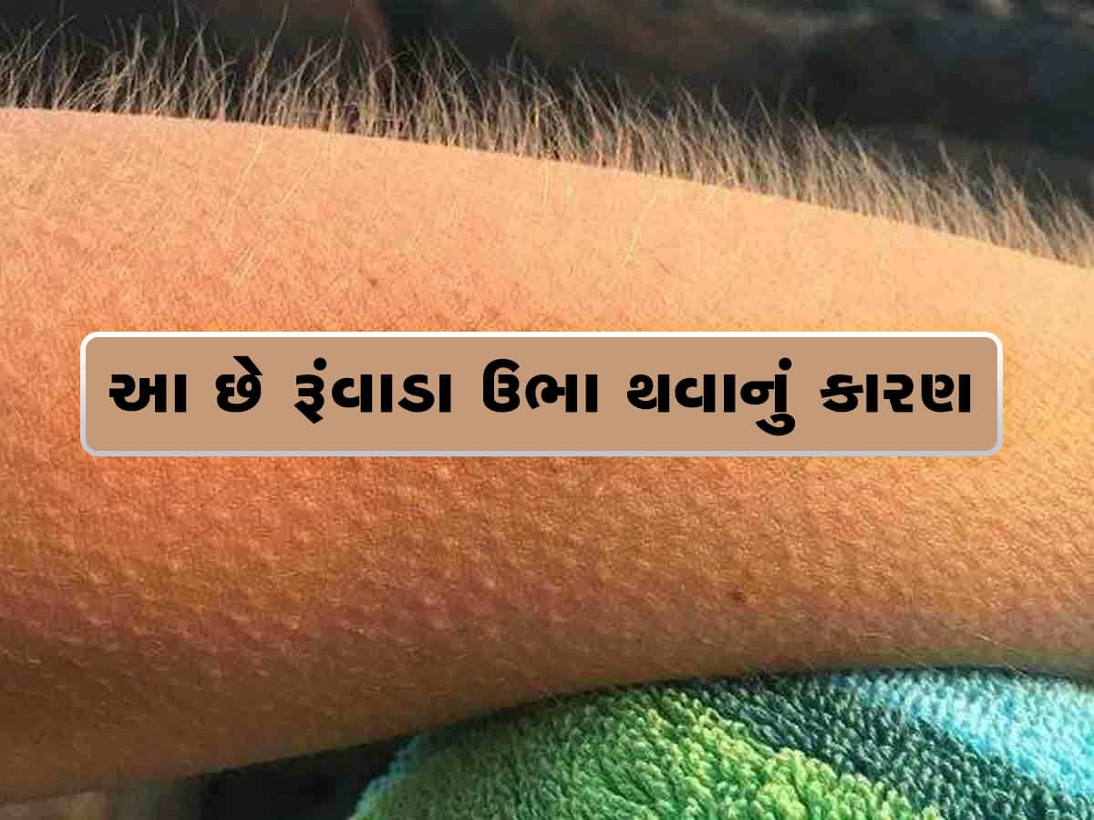 Goose Bumbs: તમારા નાની-નાની વાત પર થઈ જાય છે રૂંવાડા ઉભા, આ હોઈ શકે છે કારણ